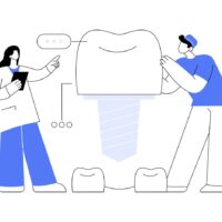 Неліктен тіс имплантациясы – тек сұлулық емес, денсаулық туралы да маңызды